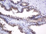 GLB1 Antibody in Immunohistochemistry (Paraffin) (IHC (P))