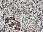 GLB1 Antibody in Immunohistochemistry (Paraffin) (IHC (P))