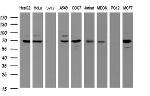 GLB1 Antibody in Western Blot (WB)