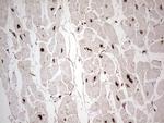 GLI1 Antibody in Immunohistochemistry (Paraffin) (IHC (P))