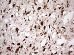 GLI1 Antibody in Immunohistochemistry (Paraffin) (IHC (P))