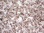 GLI1 Antibody in Immunohistochemistry (Paraffin) (IHC (P))