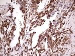 GLI1 Antibody in Immunohistochemistry (Paraffin) (IHC (P))