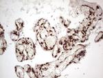 GLI1 Antibody in Immunohistochemistry (Paraffin) (IHC (P))