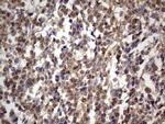 GLI1 Antibody in Immunohistochemistry (Paraffin) (IHC (P))