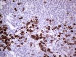 GLI1 Antibody in Immunohistochemistry (Paraffin) (IHC (P))