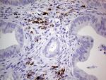 GLI1 Antibody in Immunohistochemistry (Paraffin) (IHC (P))