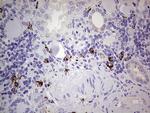 GLI1 Antibody in Immunohistochemistry (Paraffin) (IHC (P))