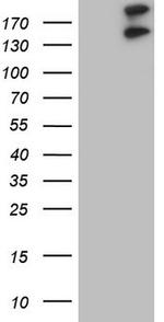 GLI2 Antibody in Western Blot (WB)