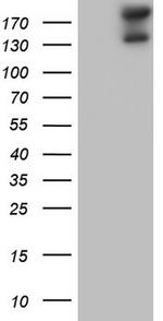 GLI2 Antibody in Western Blot (WB)