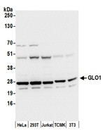 GLO1/Glyoxalase I Antibody in Western Blot (WB)