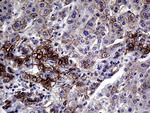 GLS2 Antibody in Immunohistochemistry (Paraffin) (IHC (P))