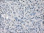 GLUL Antibody in Immunohistochemistry (Paraffin) (IHC (P))