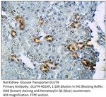 Glucose Transporter GLUT 4 Antibody in Immunohistochemistry (IHC)