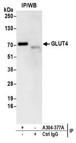 GLUT4 Antibody in Immunoprecipitation (IP)