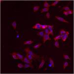 GM130 Antibody in Immunocytochemistry (ICC/IF)