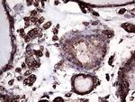 GNAS Antibody in Immunohistochemistry (Paraffin) (IHC (P))