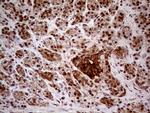 GNAS Antibody in Immunohistochemistry (Paraffin) (IHC (P))