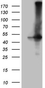 GNAS Antibody in Western Blot (WB)