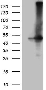 GNAS Antibody in Western Blot (WB)