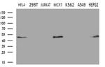 GNAS Antibody in Western Blot (WB)