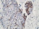 GNB2L1 Antibody in Immunohistochemistry (Paraffin) (IHC (P))