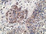 GNB2L1 Antibody in Immunohistochemistry (Paraffin) (IHC (P))