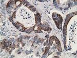 GNB2L1 Antibody in Immunohistochemistry (Paraffin) (IHC (P))