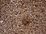 GNPAT Antibody in Immunohistochemistry (Paraffin) (IHC (P))