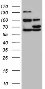 GNPAT Antibody in Western Blot (WB)