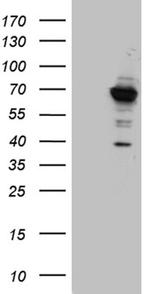 GNPAT Antibody in Western Blot (WB)