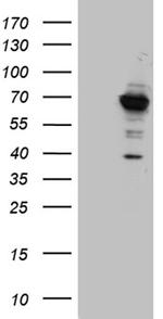 GNPAT Antibody in Western Blot (WB)