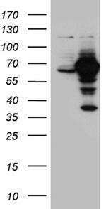 GNPAT Antibody in Western Blot (WB)