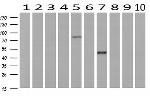 GORASP1 Antibody in Western Blot (WB)