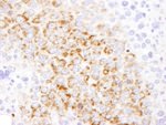 GOT2 Antibody in Immunohistochemistry (IHC)