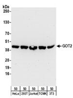 GOT2 Antibody in Western Blot (WB)