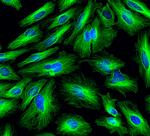 Rat IgG (H+L) Highly Cross-Adsorbed Secondary Antibody in Immunocytochemistry (ICC/IF)