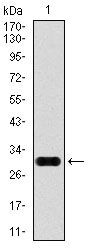 Glypican 3 Antibody in Western Blot (WB)