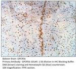 GPR56 Extracellular domain Antibody in Immunohistochemistry (IHC)