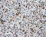 GPI Antibody in Immunohistochemistry (Paraffin) (IHC (P))