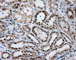 GPI Antibody in Immunohistochemistry (Paraffin) (IHC (P))