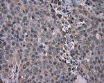 GPI Antibody in Immunohistochemistry (Paraffin) (IHC (P))