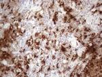 GPNMB Antibody in Immunohistochemistry (Paraffin) (IHC (P))