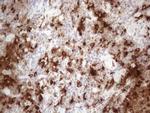 GPNMB Antibody in Immunohistochemistry (Paraffin) (IHC (P))