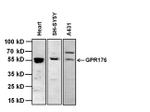 GPR176 Antibody in Western Blot (WB)