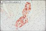 GPR39 Antibody in Immunohistochemistry (Paraffin) (IHC (P))