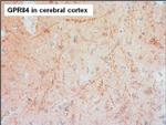 GPR84 Antibody in Immunohistochemistry (Paraffin) (IHC (P))