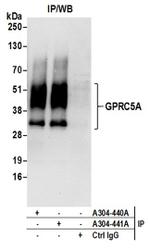 GPRC5A Antibody in Western Blot (WB)