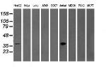 GRAP2 Antibody in Western Blot (WB)