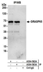 GRASP65 Antibody in Immunoprecipitation (IP)